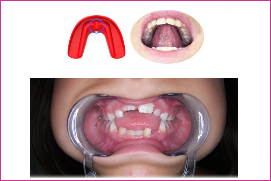  THE NEUROVEGETATIVE FUNCTIONS OF THE MOUTH