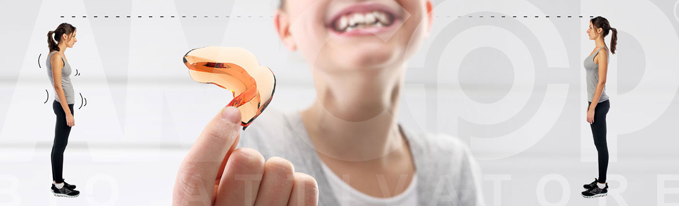 malocclusion