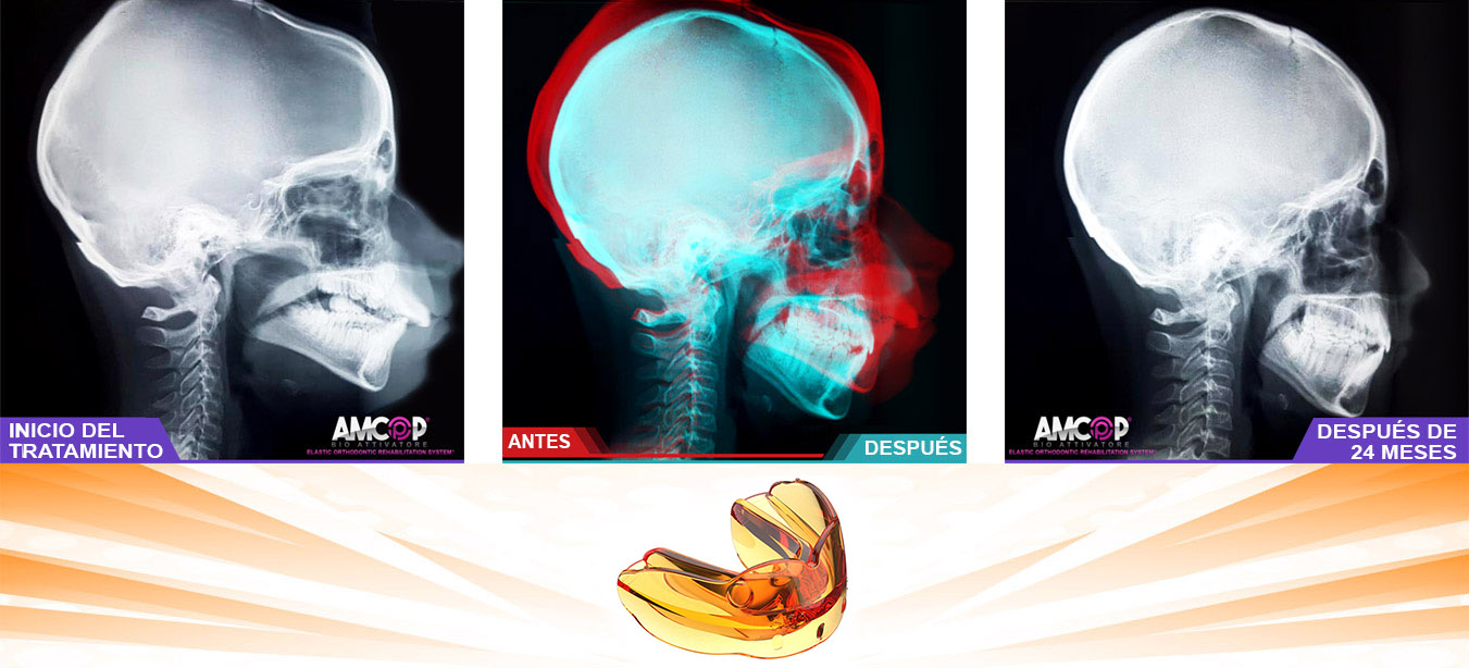 ORTOPEDIA DE LA MAxilar - CRÁNEO MANDIBULAR